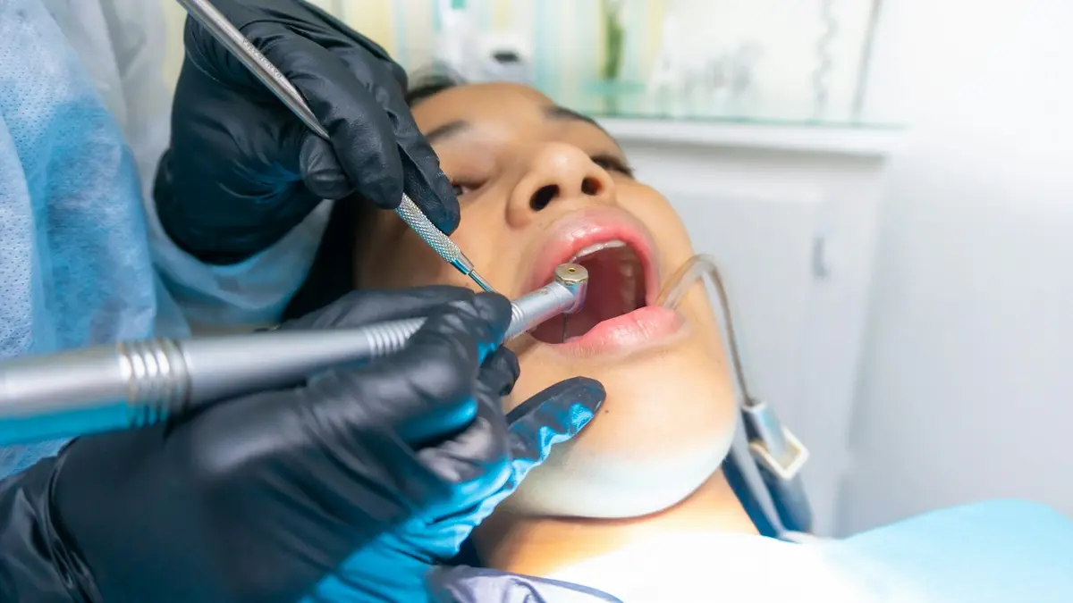 Fillings & root canal